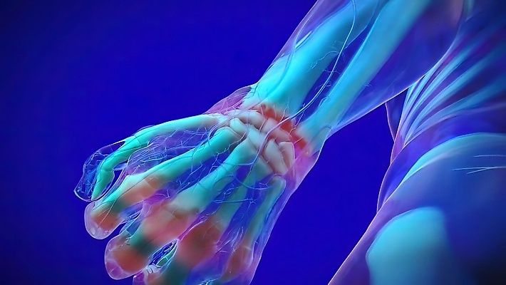 포토 JPG 해외이미지 손 과학 신체 손가락 뼈 골격 건강 손바닥 사람 사람없음 컴퓨터 약 스크린 검은색 고통 환자 의사 쌍 질병 손목 관절염 진행 고립 방사선 염증 인터페이스 정형외과 해외202309 해외포토 감정 컬러 의학 병원 신체부위 전자제품 의료진 파일형식