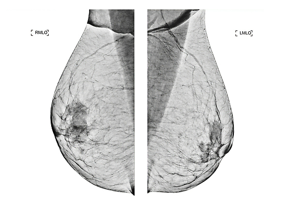 포토 JPG 해외이미지 여자 길 건강 병원 사람없음 약 시험 환자 성장 수비 오르간 질병 가슴 자르기 확인 예방 암 외과 의심 방사선 탐지 해외202309 해외포토 교육 감정 의학 모션 사람 신체부위 건반악기 파일형식