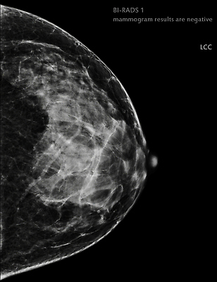포토 JPG 해외이미지 여자 건강 병원 사람없음 약 디지털 시험 환자 의사 성장 수비 오르간 질병 가슴 확인 예방 5 유방암 암 의심 방사선 탐지 해외202309 해외포토 교육 감정 의학 모션 사람 신체부위 숫자 의료진 건반악기 파일형식