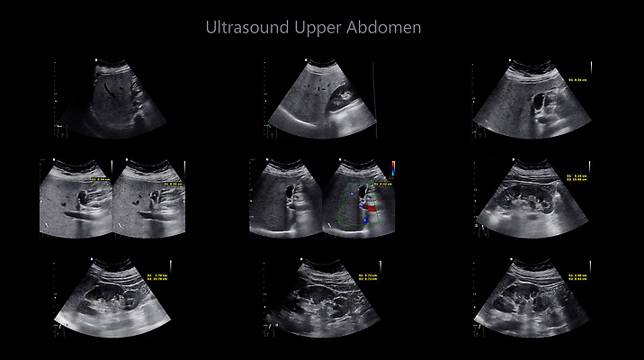 포토 JPG 해외이미지 백그라운드 신체 해부 실내 건강 병원 사람 사람없음 약 임신 고통 시험 환자 신장 질병 에코 간 감염 방광 췌장 돌봄 방사선 시범 염증 종양 해외202309 해외포토 교육 감정 의학 모션 내부 환경 장기_의학 비뇨기관 파일형식
