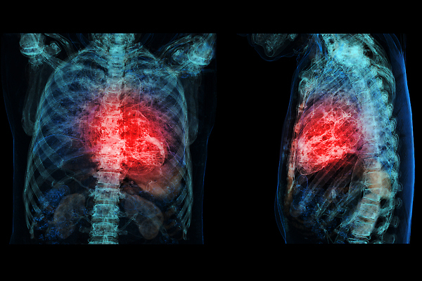 포토 JPG 해외이미지 남자 일러스트 스트레스 건강 사람 성인 사람없음 약 3D 고통 심장 긴급 맥박 호흡 질병 상처 공격 문제 동맥 궤 돌봄 타격 해로움 해외202309 해외포토 감정 컨셉 의학 모션 장기_의학 디지털합성 혈관 파일형식