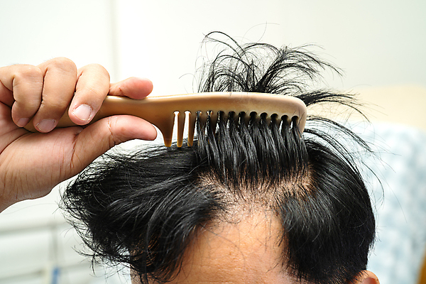 포토 JPG 해외이미지 손 들기 신체부위 머리카락 머리 머리빗 걱정 헤어관리 빗질 두피 탈모 해외202309 해외포토 감정 모션 사람 뷰티 미용용품 증상 파일형식