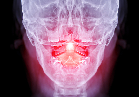 포토 JPG 해외이미지 해부 뼈 골격 흑백 건강 사람 사람없음 약 고통 시험 환자 의사 질병 상처 X 척추 관절염 목 C 고립 염증 정형외과 지도책 해골모형 해외202309 해외포토 알파벳 교육 감정 의학 촬영기법 병원 신체부위 책 모형 의료진 파일형식