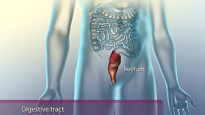 포토 JPG 해외이미지 과학 일러스트 추상 건강 사람 사람없음 내부 치료 약 3D 인포그래픽 고통 오르간 질병 작음 비만 생물학 시스템 외과 축적 돌봄 복근 염증 해외202309 해외포토 교육 감정 무늬 의학 모션 근육 병원 건반악기 크기 몸매 디지털합성 파일형식
