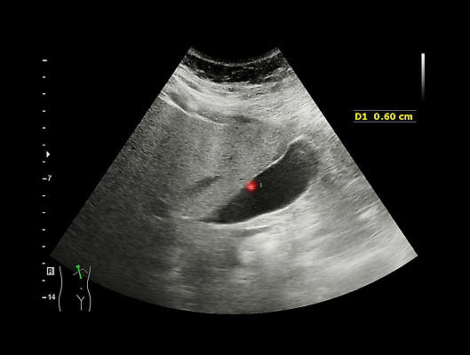 포토 JPG 해외이미지 백그라운드 신체 해부 실내 건강 병원 사람 사람없음 약 임신 고통 시험 환자 신장 질병 에코 간 감염 방광 췌장 돌봄 방사선 시범 염증 종양 해외202309 해외포토 교육 감정 의학 모션 내부 환경 장기_의학 비뇨기관 파일형식