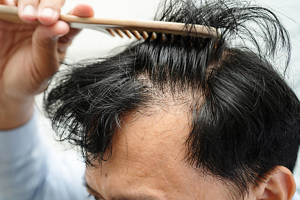 포토 JPG 해외이미지 손 들기 신체부위 머리카락 머리 머리빗 헤어관리 빗질 두피 탈모 해외202309 해외포토 모션 사람 뷰티 미용용품 증상 파일형식