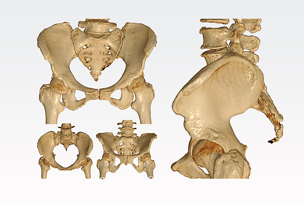포토 JPG 해외이미지 신체 해부 뼈 골격 엑스레이 나선형 사람 사람없음 3D 시험 환자 투명 오르간 콘센트 질병 엉덩이 치수 골절 깨짐 방사선 스캐너 정형외과 주입구 해외202309 해외포토 교육 컨셉 무늬 의학 병원 신체부위 건반악기 디지털합성 파일형식