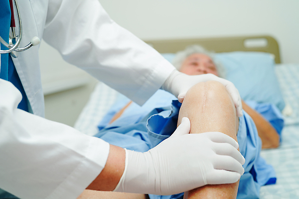 포토 JPG 해외이미지 여자 노년 신체 해부 건강 병원 사람 사람없음 치료 약 금속 산책 고통 환자 의사 긴급 수술 질병 상처 위험 자르기 간호 피부 관절염 땀 무릎 골다공증 섬유 외과 테라피 교체 돌봄 절개 치유 흉터 해외202309 해외포토 감정 컨셉 의학 모션 재질 휴식 성인 신체부위 뷰티 의료진 직물 파일형식