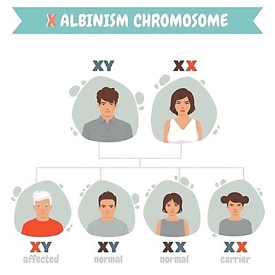 EPS 해외이미지 캐릭터 디자인 여자 얼굴 컨셉 일러스트 건강 사람 금발 세계 글로벌 뷰티 약 머리 정보 흰색 질병 DNA 6월 만화 피부 염색체 문제 돌봄 유전 차별 벡터 코딩 해외202309 해외일러스트 일러캐릭터 헤어스타일 컬러 의학 모션 신체부위 날짜 생명공학 컴퓨터교육 파일형식