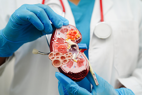 포토 JPG 해외이미지 건강 한명 상반신 성인 모형 의사 잡기 신장 질병 증상 성인한명만 해외202309 해외포토 1 의학 모션 사람 의료진 비뇨기관 성인만 파일형식