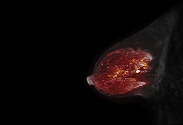 포토 JPG 해외이미지 백인 여자 리본 건강 사람없음 치료 뷰티 약 카메라 고통 환자 질병 흉부 암 돌봄 연대 종양 헬프 해외202309 해외포토 서양인 감정 의학 모션 사람 전자제품 도움 호흡기관 파일형식