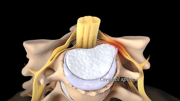 포토 JPG 해외이미지 손 일러스트 손가락 해부 뼈 골격 사람없음 약 손상 고통 기둥 디스크 질병 척추 외과 고립 방법 압력 정형외과 증상 해외202309 해외일러스트 건축 감정 컨셉 의학 병원 신체부위 파일형식