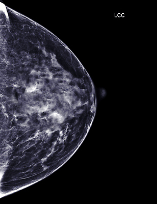 포토 JPG 해외이미지 여자 건강 병원 사람없음 디지털 시험 환자 의사 성장 수비 오르간 질병 가슴 확인 예방 유방암 암 외과 의심 방사선 탐지 해외202309 해외포토 교육 감정 의학 모션 사람 신체부위 의료진 건반악기 파일형식