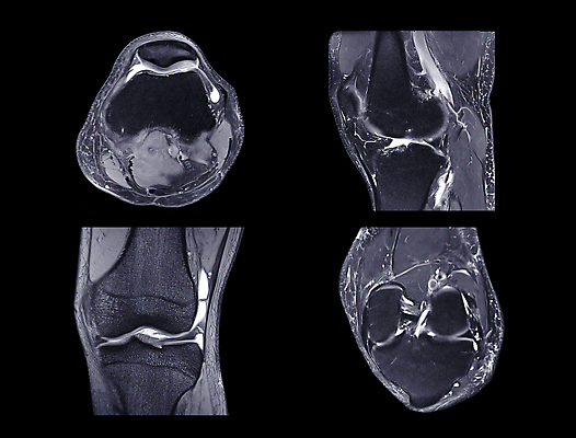 포토 JPG 해외이미지 건축물 스포츠 근육 뼈 골격 엑스레이 건강 병원 사람없음 약 건강관리 고통 시험 의사 광선 필름 확인 무릎 자석 깨짐 방사선 스캐너 연골 정형외과 해외202309 해외포토 교육 건축 감정 컨셉 의학 관리 신체부위 의료진 파일형식
