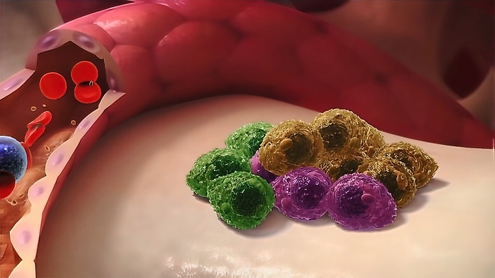 포토 JPG 해외이미지 구름 컨셉 청진기 건강 사람 타이포그라피 사람없음 치료 단어 약 3D 보라색 고통 보호 질병 가슴 예방 싸움 간 반대 암 사전 정의 돌봄 자선단체 해외202309 해외포토 자연요소 문자 감정 컬러 의학 의료기기 모션 신체부위 책 장기_의학 그룹 디지털합성 자선 파일형식