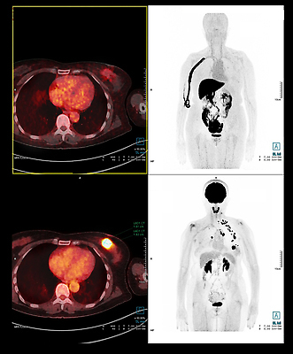 포토 JPG 해외이미지 백그라운드 신체 사람없음 암 궤 돌봄 해외202309 해외포토 모션 질병 파일형식