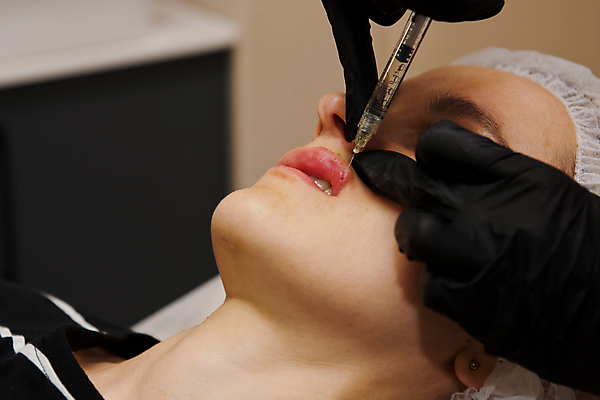 포토 JPG 해외이미지 백인 여자 얼굴 장갑 건강 병원 주사기 한명 치료 뷰티 약 화장품 환자 바늘 입 액체 닫기 떨어짐 플라스틱 미용사 피부 입술 피부관리 리프트 주사약 외과 테라피 순서 돌봄 바디케어 방법 해외202309 해외포토 서양인 직업 1 잡화 컨셉 의학 의료기기 모션 재질 사람 신체부위 도구 파일형식