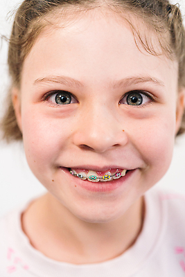 포토 JPG 해외이미지 백인 얼굴 어린이 한명 사람 치아 해외202309 해외포토 서양인 1 신체부위 소화기관 파일형식