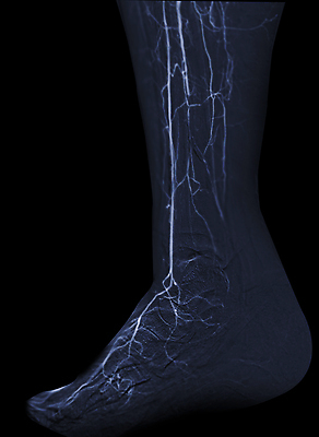 포토 JPG 해외이미지 사람없음 치료 약 장비 질병 함선 동맥 순서 해외202309 해외포토 배_교통 의학 혈관 파일형식