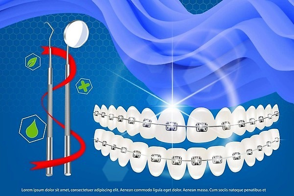 EPS 해외이미지 디자인 백그라운드 곡선 일러스트 건강 치과 병원 미소 사람 그래픽 치료 약 장비 의사 흰색 도구 입 투명 치아 칫솔 치과의사 고정 턱 고립 돌봄 위생관리 치아교정 치통 벡터 해외202309 해외일러스트 선 컬러 의학 모션 표정 관리 신체부위 위생용품 의료진 소화기관 질병 교정 파일형식
