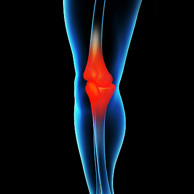 포토 JPG 해외이미지 신체 일러스트 해부 엑스레이 건강 사람 사람없음 약 건강관리 고통 관절염 관절 골다공증 외과 연골 염증 정형외과 증상 해외202004 해외포토 감정 의학 뼈 병원 관리 질병 파일형식