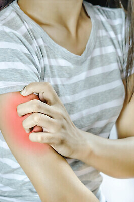 포토 JPG 해외이미지 무료이미지 여자 한명 성인 피부 팔 가려움 모기 증상 의료성형뷰티 성인여자한명만 해외202004 긁기 해외포토 1 모션 사람 신체부위 해충 여자한명만 성인여자만 파일형식 무료콘텐츠