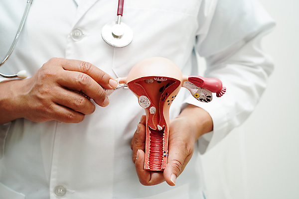 포토 JPG 해외이미지 손 건강 병원 한명 상반신 성인 모형 의사 잡기 질병 자궁 성인한명만 해외202309 해외포토 1 의학 모션 사람 신체부위 의료진 장기_의학 성인만 파일형식