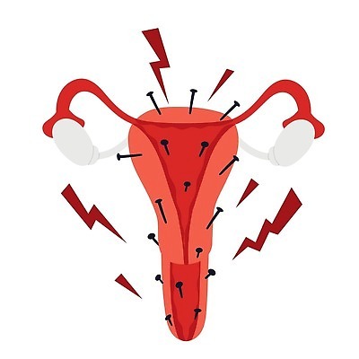 EPS 해외이미지 캐릭터 여자 컨셉 신체 일러스트 해부 건조 실내 건강 미술 사람 내부 고통 오르간 위험 만화 척추 생물학 순환 감염 튜브 문제 자궁 암 기간 염증 캐리커처 벡터 해외202309 해외일러스트 일러캐릭터 교육 감정 의학 모션 문화예술 뼈 장기_의학 건반악기 질병 그림 파일형식