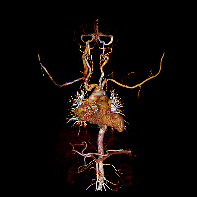 포토 JPG 해외이미지 백그라운드 해부 엑스레이 병원 사람없음 3D 검은색 장비 시험 환자 심장 질병 함선 시스템 동맥 방사선 심장병 해외202309 해외포토 교육 컬러 배_교통 의학 장기_의학 디지털합성 혈관 파일형식