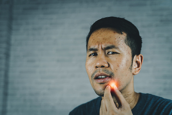 포토 JPG 해외이미지 백인 외관 남자 감정 얼굴 백그라운드 신체 건강 한명 사람 동양인 성인 치료 빛 수건 뷰티 약 목욕 고통 회색 짜증 질병 피부 걱정 감염 문제 여드름 알레르기 돌봄 샤워실 염증 위생관리 해외202309 해외포토 서양인 1 컬러 의학 모션 관리 인종 신체부위 위생용품 청결 샤워시설 파일형식