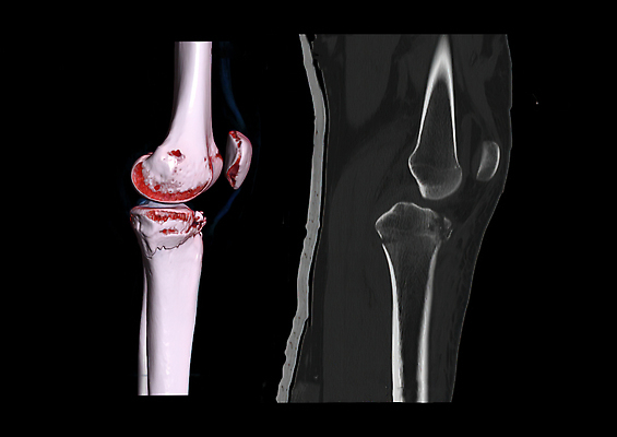 포토 JPG 해외이미지 교육 스포츠 과학 백그라운드 신체 일러스트 해부 뼈 골격 엑스레이 건강 병원 사람 사람없음 약 3D 고통 시험 환자 사건 외과 골절 깨짐 방사선 스캐너 연골 정형외과 증상 해외202309 해외일러스트 감정 컨셉 의학 디지털합성 파일형식