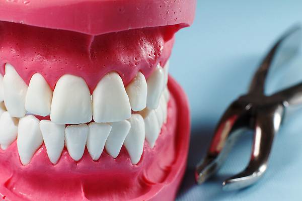 포토 JPG 해외이미지 모델 라이프스타일 교육 컨셉 해부 건강 치과 병원 집게 사람 사람없음 일상 치료 약 장비 공구 신선 입 구멍 치아 보호 위생 상품 묘사 치과의사 턱 틀니 거짓 돌봄 보철 위생관리 인공 잇몸 철강 치아교정 해외202309 해외포토 신체 의학 모션 관리 라이프 생활 신체부위 의사 도구 소화기관 교정 파일형식