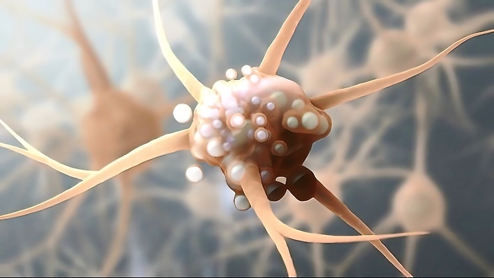 포토 JPG 해외이미지 과학 백그라운드 통신 해부 검은배경 생물 아이디어 세포 실내 사람 사람없음 빨간색 약 머리 그물 네트워크 불안 뇌 생물학 신호 만들기 시스템 공상 바이오 환상 인트로 해외202309 해외포토 교육 감정 컬러 컨셉 의학 모션 내부 신체부위 검은색 파일형식