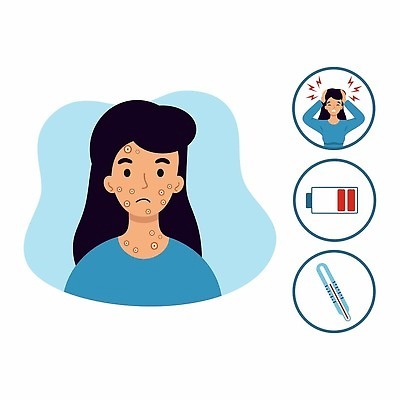 EPS 해외이미지 디자인 배너 얼굴 신체 일러스트 그래픽 약 고통 열 주름 바이러스 질병 폐기물 온도계 만화 크림 두통 윤곽 감염 온도 문제 스킨케어 주근깨 여드름 알레르기 끓이기 반응 증상 벡터 해외202309 해외일러스트 감정 의학 모션 신체부위 뷰티 점 쓰레기 파일형식 사람