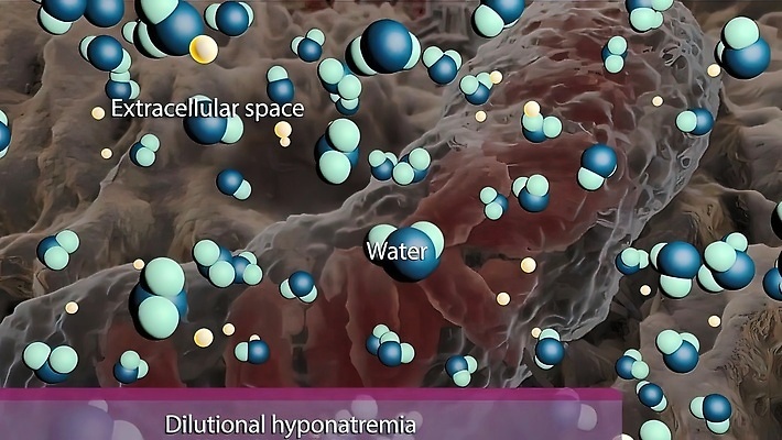 포토 JPG 해외이미지 과학 세포 사람 사람없음 방어 바이러스 질병 생물학 만들기 시스템 암 테라피 박테리아 췌장 면역력 종양 해외202309 해외포토 교육 의학 모션 어류 뷰티 장기_의학 파일형식