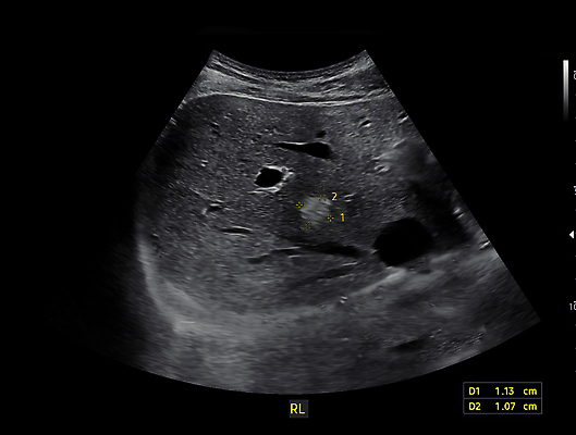 포토 JPG 해외이미지 백그라운드 신체 해부 실내 건강 병원 사람 사람없음 약 임신 고통 시험 환자 신장 질병 에코 간 감염 방광 췌장 돌봄 방사선 시범 염증 종양 해외202309 해외포토 교육 감정 의학 모션 내부 환경 장기_의학 비뇨기관 파일형식