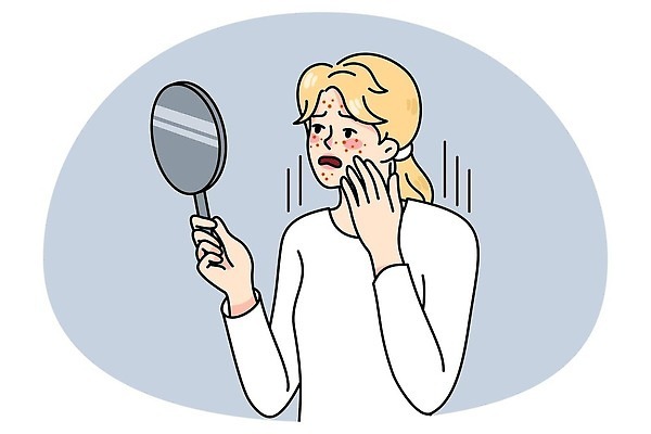 EPS 해외이미지 여자 얼굴 컨셉 일러스트 스트레스 건강 사람 성인 치료 빨간색 뷰티 약 거울 슬픔 짜증 점 질병 수분 피부 크림 걱정 피부관리 그림 윤곽 감염 문제 여드름 돌봄 사춘기 염증 위생관리 트러블 해로움 흉터 벡터 해외202309 해외일러스트 감정 컬러 의학 모션 관리 신체부위 상처 파일형식