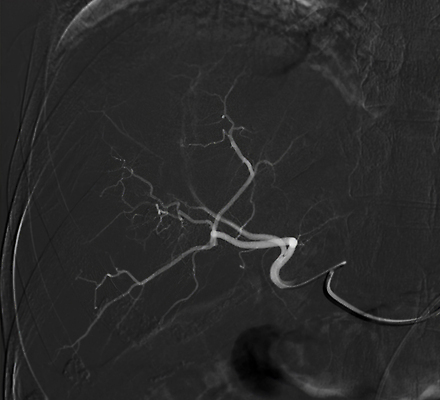 포토 JPG 해외이미지 세포 엑스레이 건강 병원 사람없음 약 장비 환자 의사 긴급 수술 선택 질병 위험 간 시트 외과 덩어리 동맥 방사선 복근 종양 해외202309 해외포토 컨셉 의학 근육 치료 의료진 장기_의학 혈관 파일형식