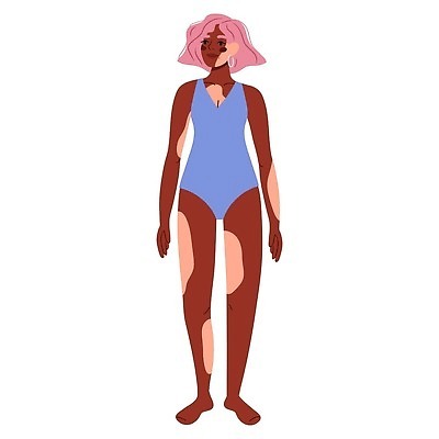 EPS 해외이미지 캐릭터 여자 행복 포스터 얼굴 컨셉 신체 일러스트 건강 사랑 사람 성인 세계 뷰티 자신감 플랫 질병 만화 피부 문제 고립 돌봄 유전 지원 벡터 해외202309 해외일러스트 일러캐릭터 감정 의학 모션 신체부위 파일형식