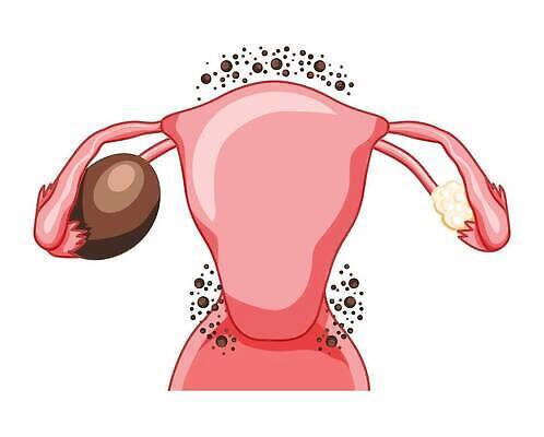 EPS 해외이미지 모델 여자 벽 신체 일러스트 해부 실내 사람 내부 약 초콜릿 조직 오르간 스케치 순환 지역 시스템 자궁 암 종양 복부 벡터 해외202309 해외일러스트 의학 모션 디저트 미술 신체부위 건반악기 장기 질병 파일형식 악기 음식 문화예술 건반 음악