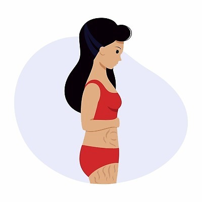 EPS 해외이미지 캐릭터 디자인 다이어트 일러스트 건강 병원 사람 그래픽 치료 약 임신 고통 환자 의사 출산 플랫 질병 엉덩이 피부 크림 영웅 흉터 셀룰라이트 벡터 해외202309 해외일러스트 일러캐릭터 감정 의학 신체부위 의료진 상처 파일형식 직업