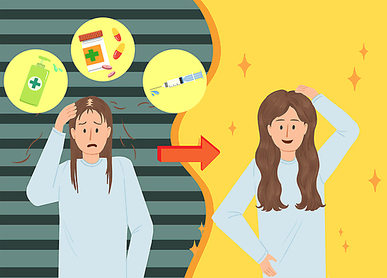 PSD 여자 화살표 허리손 일러스트 주사기 손짓 상반신 성인 두명 치료 반짝임 알약 약 노란색 머리카락 자신감 비교 약병 완치 탈모 탈모클리닉 성인여자만 국내일러스트 감정 컬러 포즈 컨셉 의학 의료기기 모션 사람 머리 클리닉 증상 병_담는 여자만 성인만 파일형식