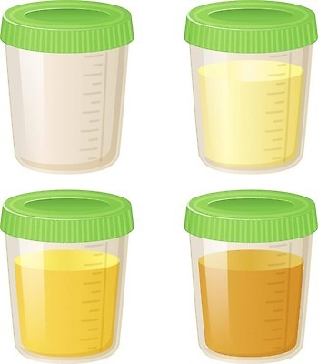 EPS 해외이미지 과학 일러스트 건강 병원 실험 사람 약 노란색 견본 건강관리 임신 시험 의사 항아리 액체 실험실 플랫 결과 질병 컨테이너 플라스틱 만화 분석 생물학 미생물 고립 당뇨병 제어 화학물질 벡터 도핑 해외202310 해외일러스트 교육 산업 컬러 컨셉 의학 재질 생물 관리 의료진 도자기 화학 파일형식