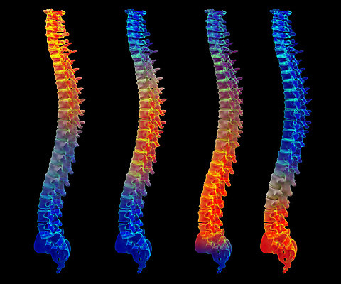 포토 JPG 해외이미지 신체 뼈 골격 엑스레이 건강 사람없음 3D 고통 환자 질병 척추 요통 해외202004 해외포토 감정 의학 디지털합성 허리통증 파일형식