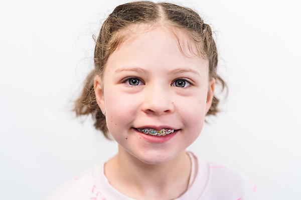 포토 JPG 해외이미지 백인 얼굴 어린이 한명 사람 치아 해외202310 해외포토 서양인 1 신체부위 소화기관 파일형식