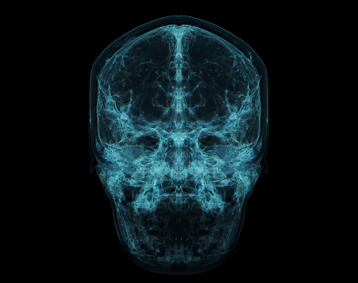 포토 JPG 해외이미지 과학 신체 일러스트 해부 미래 건강 병원 실험 사람 사람없음 그래픽 컴퓨터 약 머리 3D 디지털 스크린 장비 환자 실험실 질병 스마트 뇌 암 혁명 방사선 스캐너 인터페이스 종양 타격 해골모형 홀로그램 가상 해외202310 해외포토 컨셉 의학 모션 신체부위 전자제품 모형 디지털합성 파일형식
