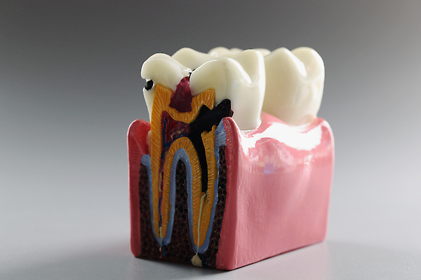 포토 JPG 해외이미지 모델 디자인 교육 과학 백그라운드 컨셉 십자가 부분 해부 뼈 건강 치과 병원 사람 성인 사람없음 그래픽 치료 학습 약 회색 환자 흰색 오픈 입 가르침 치아 치과의사 생물학 시스템 자원 턱 틀니 순서 돌봄 보철 위생관리 치아교정 치통 구강학 해외202310 해외포토 컬러 의학 모션 관리 신체부위 의사 소화기관 질병 교정 파일형식