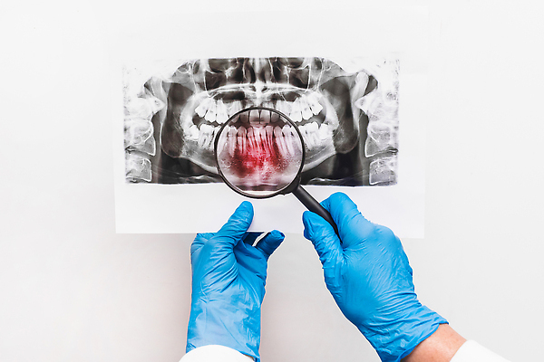 포토 JPG 해외이미지 직업 해부 뼈 골격 엑스레이 건강 치과 병원 한명 사람 치료 약 머리 건강관리 고통 장비 시험 환자 의사 광선 흰색 입 투명 치아 질병 X 필름 부식 치과의사 외과 턱 돌봄 방사선 위생관리 치통 해골모형 해외202310 해외포토 1 알파벳 교육 감정 컬러 의학 모션 관리 신체부위 모형 의료진 소화기관 파일형식