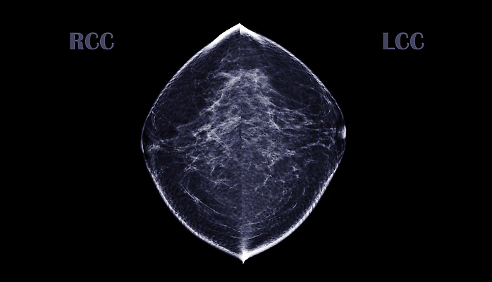 포토 JPG 해외이미지 여자 2 건강 병원 사람없음 시험 환자 의사 성장 수비 오르간 질병 가슴 확인 예방 유방암 암 외과 발견 의심 방사선 탐지 해외202310 해외포토 교육 감정 의학 모션 사람 신체부위 의료진 건반악기 파일형식