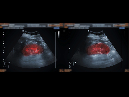 포토 JPG 해외이미지 백그라운드 신체 해부 실내 건강 병원 사람 사람없음 약 임신 고통 시험 환자 신장 질병 에코 간 감염 자궁 방광 췌장 돌봄 방사선 복근 시범 염증 종양 해외202310 해외포토 교육 감정 의학 모션 근육 내부 환경 장기_의학 비뇨기관 파일형식